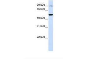 anti-Rhomboid 5 Homolog 1 (RHBDF1) (AA 290-339) antibody