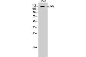 Image no. 1 for anti-Abelson Murine Leukemia Viral Oncogene Homolog 1/2 (ABL1/ABL2) (Lys5) antibody (ABIN3183134)
