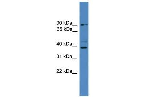 Image no. 1 for anti-Zinc Finger, RAN-Binding Domain Containing 1 (ZRANB1) (C-Term) antibody (ABIN2788030)