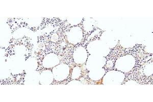 Image no. 4 for anti-Kruppel-Like Factor 1 (erythroid) (KLF1) (N-Term) antibody (ABIN184728)