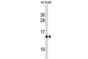 MS4A13 抗体  (N-Term)