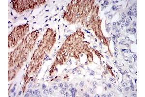 Image no. 4 for anti-Niemann-Pick Disease, Type C1 (NPC1) (AA 34-174) antibody (ABIN1724876)