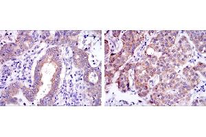 Image no. 2 for anti-REL proto-oncogene (c-Rel) antibody (ABIN1500663)