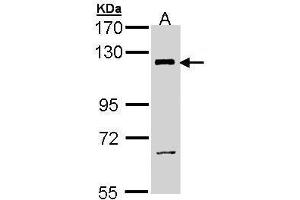 Image no. 4 for anti-Phosphoinositide-3-Kinase, Catalytic, beta Polypeptide (PIK3CB) (Internal Region) antibody (ABIN2856792)