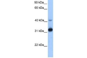 Image no. 1 for anti-Trans-2,3-Enoyl-CoA Reductase (TECR) (Middle Region) antibody (ABIN635589)