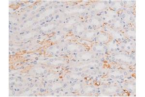 Image no. 1 for anti-Mast/stem Cell Growth Factor Receptor (KIT) (pTyr703) antibody (ABIN6255994)