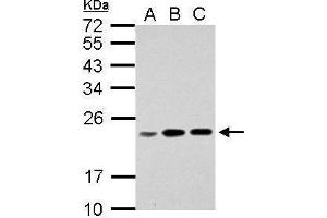 WB Image Sample (30 ug of whole cell lysate) A: Jurkat B: Raji C: K562 12% SDS PAGE antibody diluted at 1:1000
