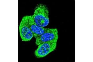 Image no. 5 for anti-HRas proto-oncogene, GTPase (HRAS) (AA 146-176) antibody (ABIN3031138)