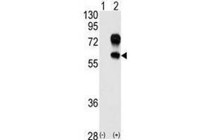 Image no. 1 for anti-Kringle Containing Transmembrane Protein 1 (KREMEN1) (N-Term) antibody (ABIN357077)