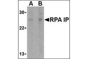Image no. 2 for anti-RPA Interacting Protein (RPAIN) (C-Term) antibody (ABIN500632)