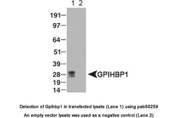 anti-Glycosylphosphatidylinositol Anchored High Density Lipoprotein Binding Protein 1 (GPIHBP1) (AA 100-170), (Internal Region) antibody
