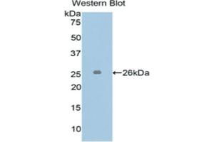 Image no. 3 for L1 Cell Adhesion Molecule (L1CAM) ELISA Kit (ABIN6720565)