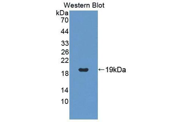 anti-T-Cell Lymphoma Invasion and Metastasis 1 (TIAM1) (AA 1261-1397) antibody
