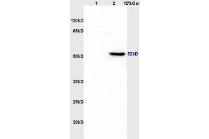Image no. 1 for anti-Keratin 12 (KRT12) (AA 151-250) antibody (ABIN872955)