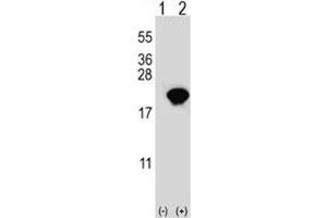 Image no. 7 for anti-Peptidylprolyl Cis/trans Isomerase, NIMA-Interacting 1 (PIN1) (AA 30-56) antibody (ABIN3028920)