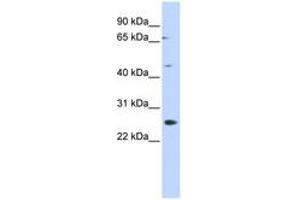 Image no. 1 for anti-Spermatogenesis Associated 22 (SPATA22) (N-Term) antibody (ABIN6741482)