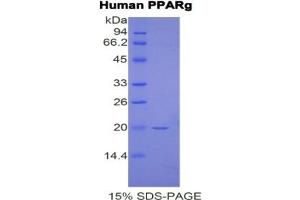 Image no. 2 for Peroxisome Proliferator-Activated Receptor gamma (PPARG) ELISA Kit (ABIN6574233)