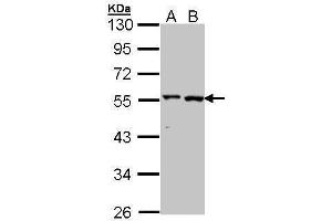 WB Image Sample (30 ug of whole cell lysate) A: A431 , B: Hela 10% SDS PAGE antibody diluted at 1:1000