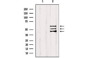 Image no. 4 for anti-SHC (Src Homology 2 Domain Containing) Transforming Protein 1 (SHC1) antibody (ABIN6265062)
