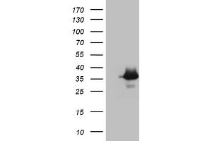 Image no. 2 for anti-Aspartoacylase (ASPA) (AA 77-313) antibody (ABIN2716065)