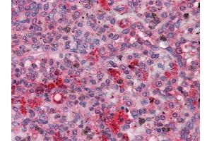 Image no. 1 for anti-Gardner-Rasheed Feline Sarcoma Viral (V-Fgr) Oncogene Homolog (FGR) antibody (ABIN969143)