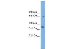 Image no. 1 for anti-Phosphatidic Acid Phosphatase Type 2A (PPAP2A) (AA 35-84) antibody (ABIN6745591)