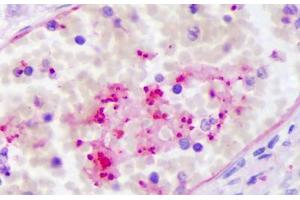 Anti-PPBP antibody IHC staining of human intravascular platelets.