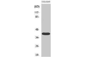 Western Blotting (WB) image for anti-Mitogen-Activated Protein Kinase-Activated Protein Kinase 3 (MAPKAPK3) (C-Term) antibody (ABIN3183087)