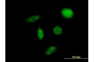 Image no. 2 for anti-Solute Carrier Family 29 (Nucleoside Transporters), Member 2 (SLC29A2) (AA 1-456) antibody (ABIN516583)