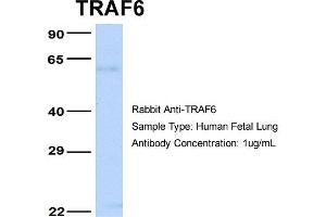 Image no. 3 for anti-TNF Receptor-Associated Factor 6 (TRAF6) (Middle Region) antibody (ABIN2779305)