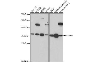 KCNK6 Antikörper  (AA 254-313)