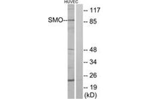 Image no. 1 for anti-Smoothened Homolog (Drosophila) (SMO) (AA 68-117) antibody (ABIN1535995)