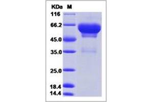 Image no. 1 for Secretogranin III (SCG3) (AA 1-471) protein (His tag) (ABIN5499584)