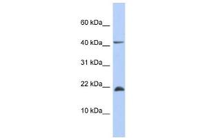 Image no. 1 for anti-SFRS12-Interacting Protein 1 (SFRS12IP1) (Middle Region) antibody (ABIN631036)