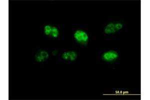 Image no. 6 for anti-F-Box Protein 7 (FBXO7) (AA 1-522) antibody (ABIN1327602)