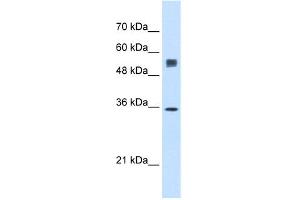 Image no. 3 for anti-Signal Sequence Receptor, alpha (SSR1) (N-Term) antibody (ABIN2782211)