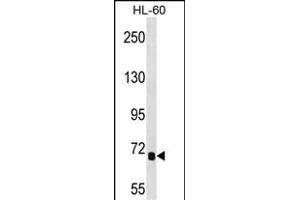 IL1RL2 Antibody (Center) 16964c western blot analysis in HL-60 cell line lysates (35 μg/lane).