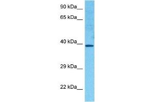Image no. 3 for anti-Homeobox C11 (HOXC11) (Middle Region) antibody (ABIN2779771)