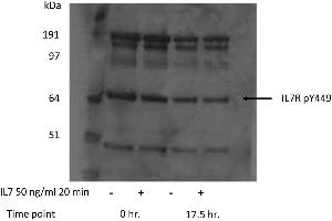 Image no. 1 for anti-Interleukin 7 Receptor (IL7R) (pTyr449) antibody (ABIN233847)
