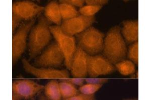 Immunofluorescence analysis of HeLa cells using ZC3H7A Polyclonal Antibody at dilution of 1:100.