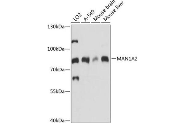 MAN1A2 anticorps  (AA 60-180)