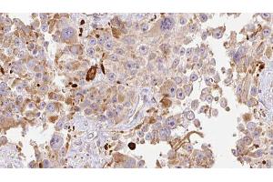 Image no. 3 for anti-Hyaluronan and Proteoglycan Link Protein 1 (HAPLN1) (N-Term) antibody (ABIN6262149)