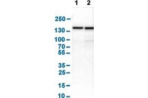 Image no. 3 for anti-Ubiquitin Conjugation Factor E4 B (UBE4B) (AA 2-67) antibody (ABIN5774346)