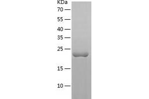 RHOB Protein (AA 1-193) (His tag)