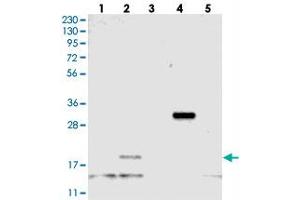 Image no. 2 for anti-YbeY Metallopeptidase (Putative) (ybeY) antibody (ABIN5649666)