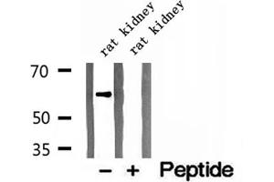 Image no. 1 for anti-Cytoskeleton-Associated Protein 4 (CKAP4) (C-Term) antibody (ABIN6260850)