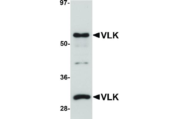 anti-Protein Kinase Domain Containing, Cytoplasmic Homolog (Mouse) (PKDCC) (Internal Region) antibody