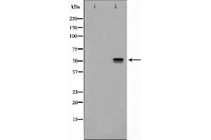 Image no. 1 for anti-Tachykinin Receptor 1 (TACR1) (Internal Region) antibody (ABIN6257514)