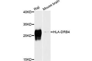 Image no. 2 for anti-Major Histocompatibility Complex, Class II, DR beta 4 (HLA-DRB4) antibody (ABIN4903935)