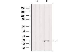 PIGP antibody